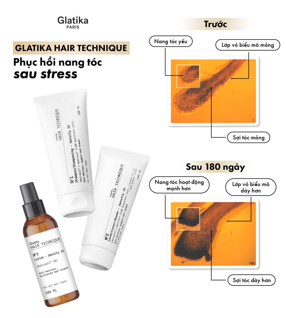 Glatika Hair Technique - Phục hồi nang tóc sau Stress