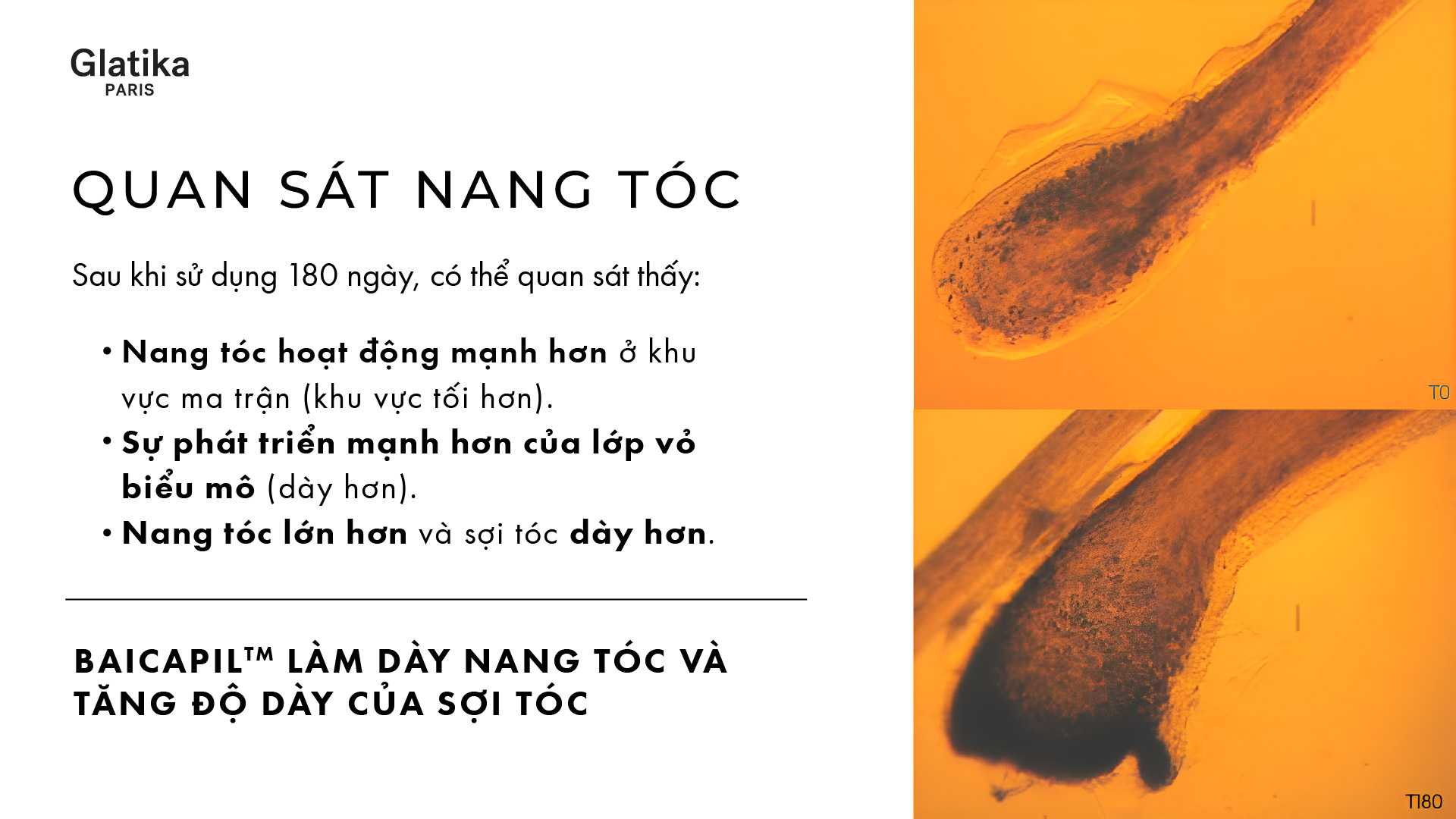 Bao lâu thì thấy hiệu quả khi dùng xịt mọc tóc Glatika?