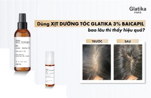 Xịt dưỡng tóc Glatika 3% Baicapil