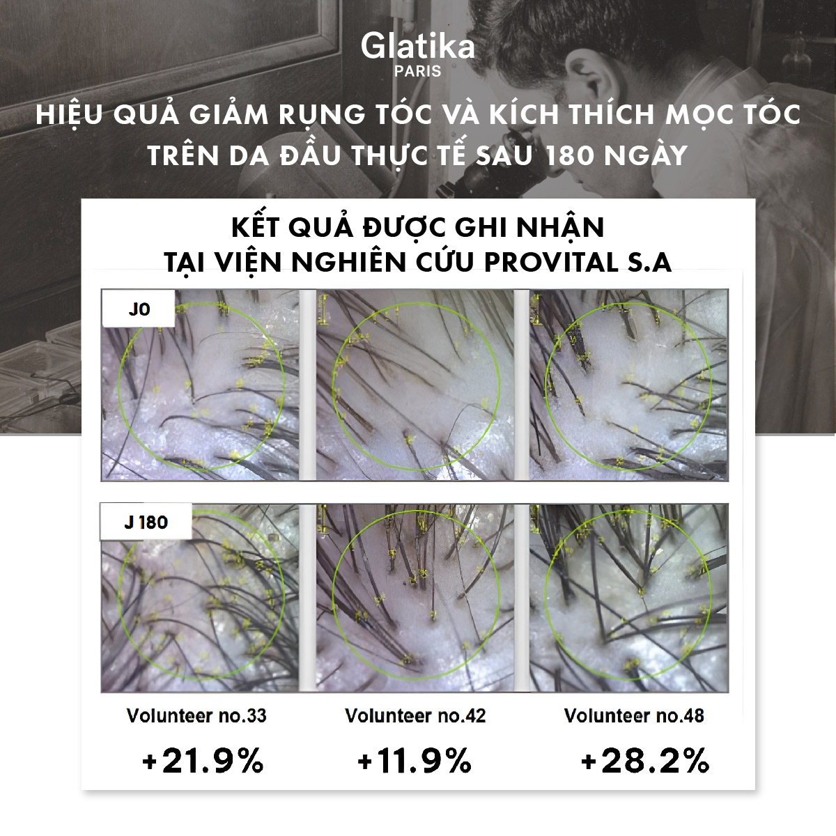 Hiệu quả của xịt mọc tóc phụ thuộc vào chu kỳ sinh học của nang tóc